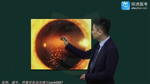 2024年阿虎医考334眼科学主治医师中级职称考试视频笔试押题考点题库培训葡萄膜病(1)