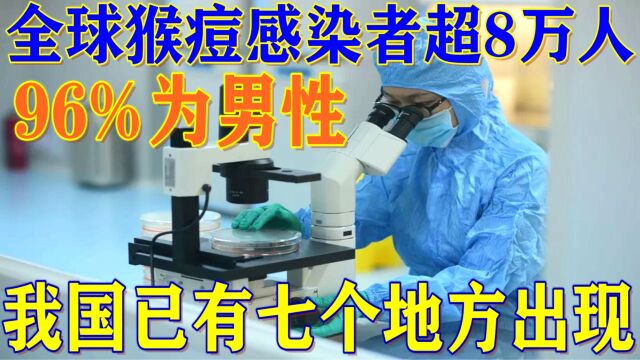 全球猴痘感染超8万人,年轻男性占比高达96%!我国已有七个地方出现