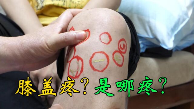 膝盖疼是哪疼?告诉你膝关节10个疼痛点,以后不要说膝盖疼了