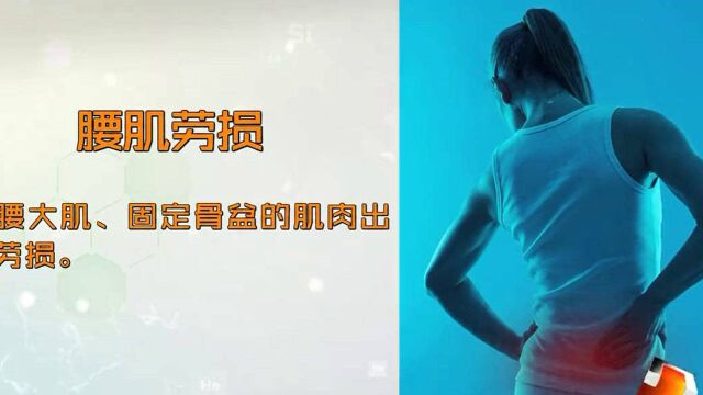 注意:常见的腰部疾病→