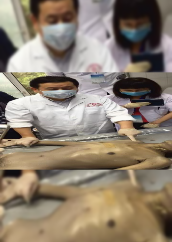 液针刀尸体标本