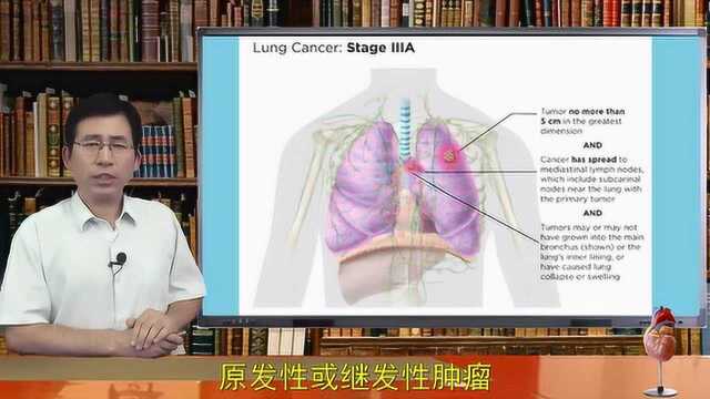 肺癌分期:0期、1期、2期、3期、4期有什么不同,危险性多大?转移了吗?