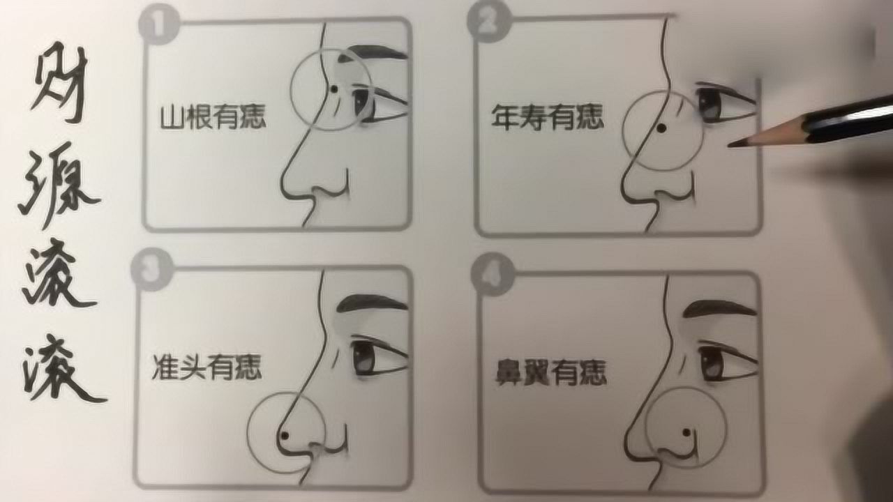鼻子上长痣有什么寓意吗解读不同位置的运势你有吗