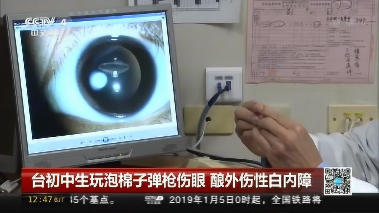 台初中生玩泡棉子弹枪伤眼酿外伤性白内障_高清1080P在线观看平台_腾讯视频