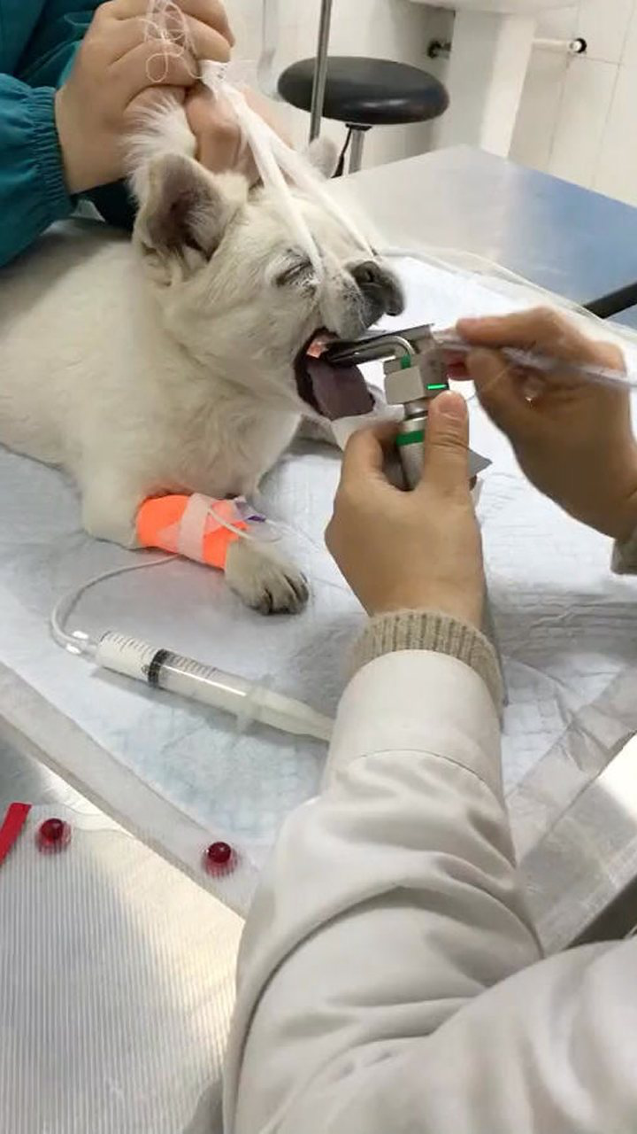 麻醉后的气管插管动作娴熟