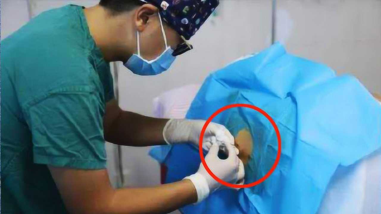 为什么女性在生产前都要被“刮毛”？别害羞了,看看吧！_高清