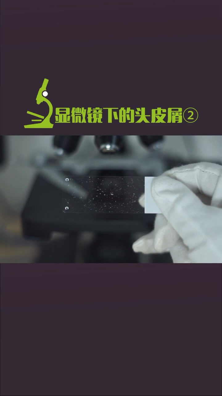 顯微鏡下的頭皮屑