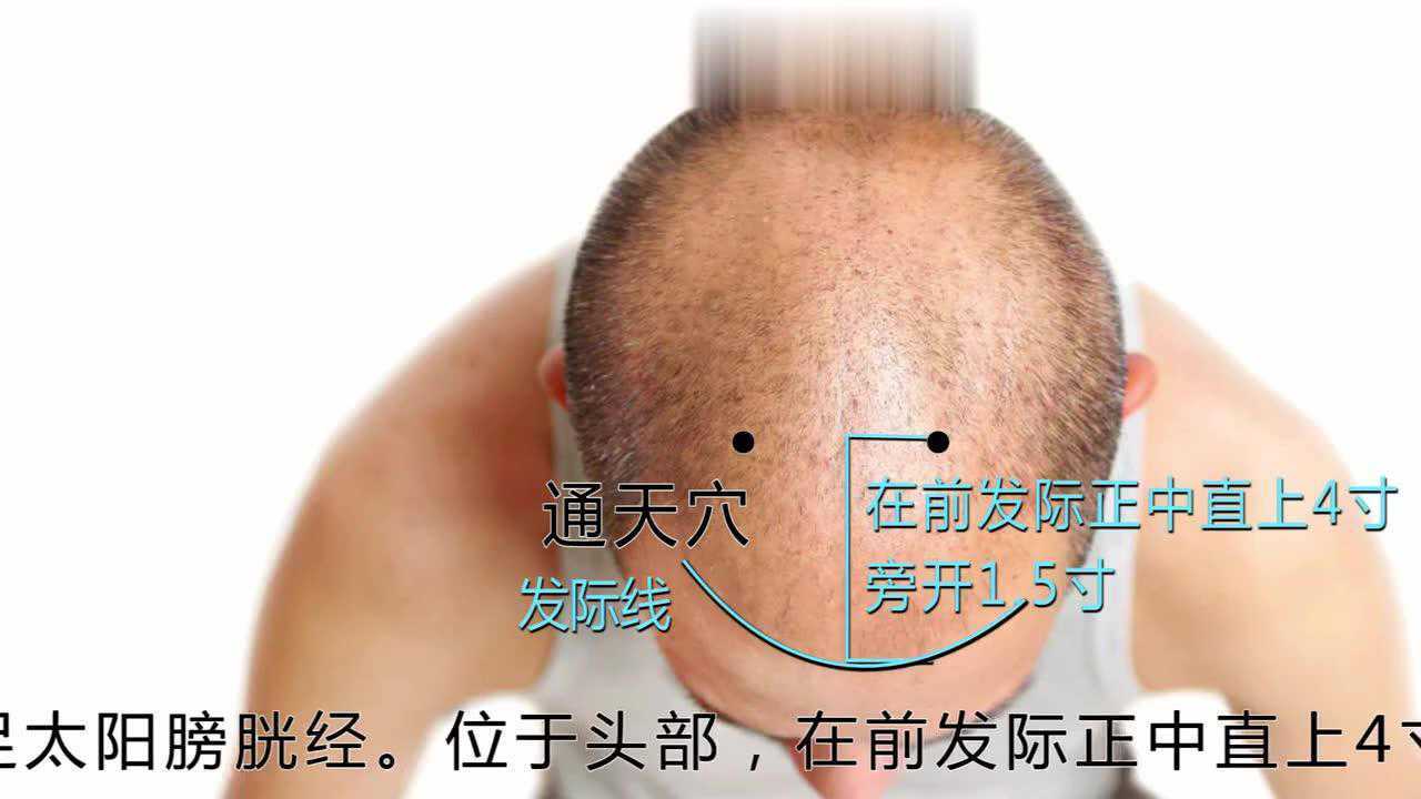 通天穴的位置_腾讯视频