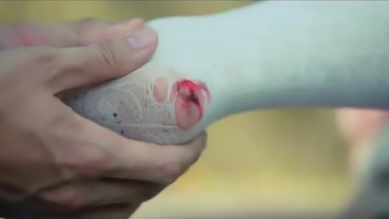 美女穿丝袜去爬山，没想到连皮带袜都磨破了，我都替她心疼_高清