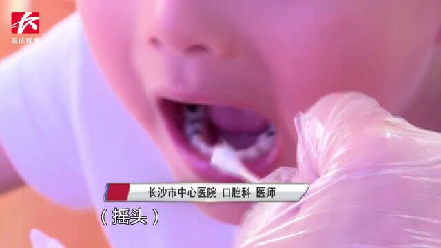 家长当心!幼儿园近半孩子患有龋齿,主要诱因是甜食!