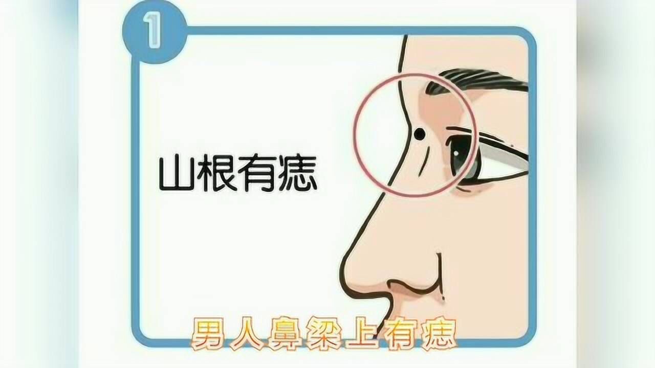 克妻痣,妨妻痣 有哪些?了解下_腾讯视频