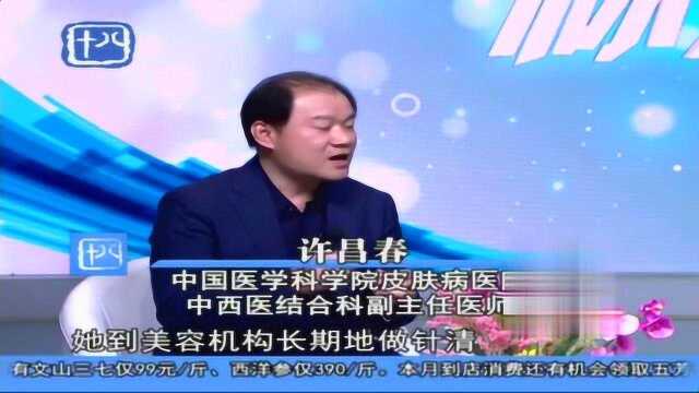 痘痘小常识:自行使用祛痘膏去除痤疮,可能导致不必要的风险