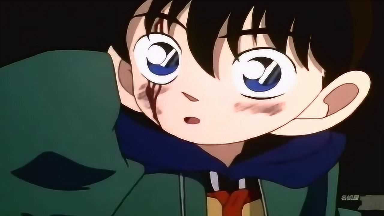 名侦探柯南柯南受伤了头上流血了小兰会心疼的