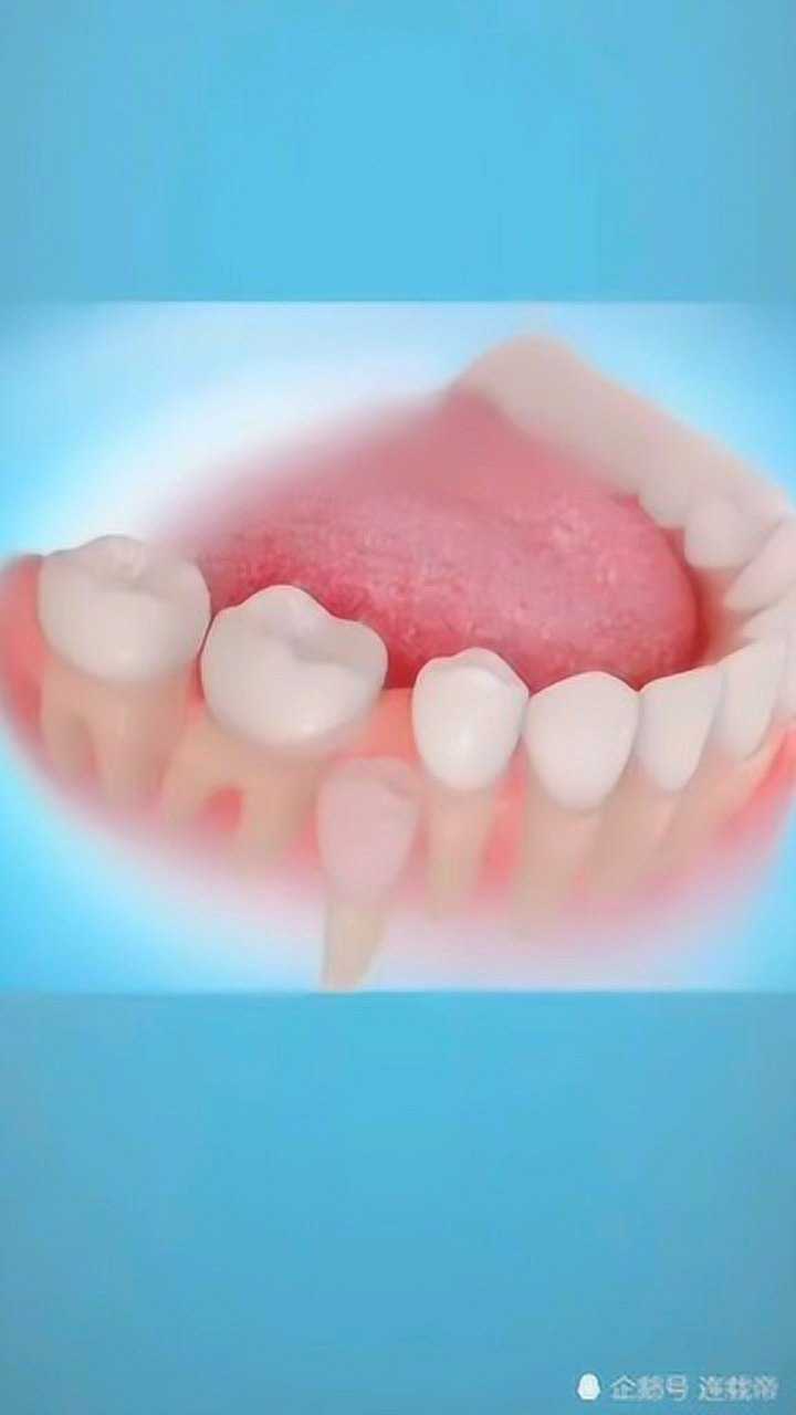 乳牙提前拔掉的注意要做个间隙保持器了.不然临牙占位就长不回原位了