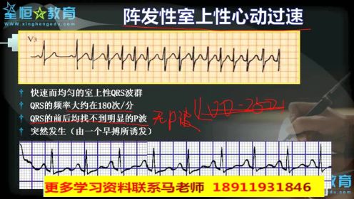 星恒教育免费课程 技能实操讲解 刘江老师 心电图2