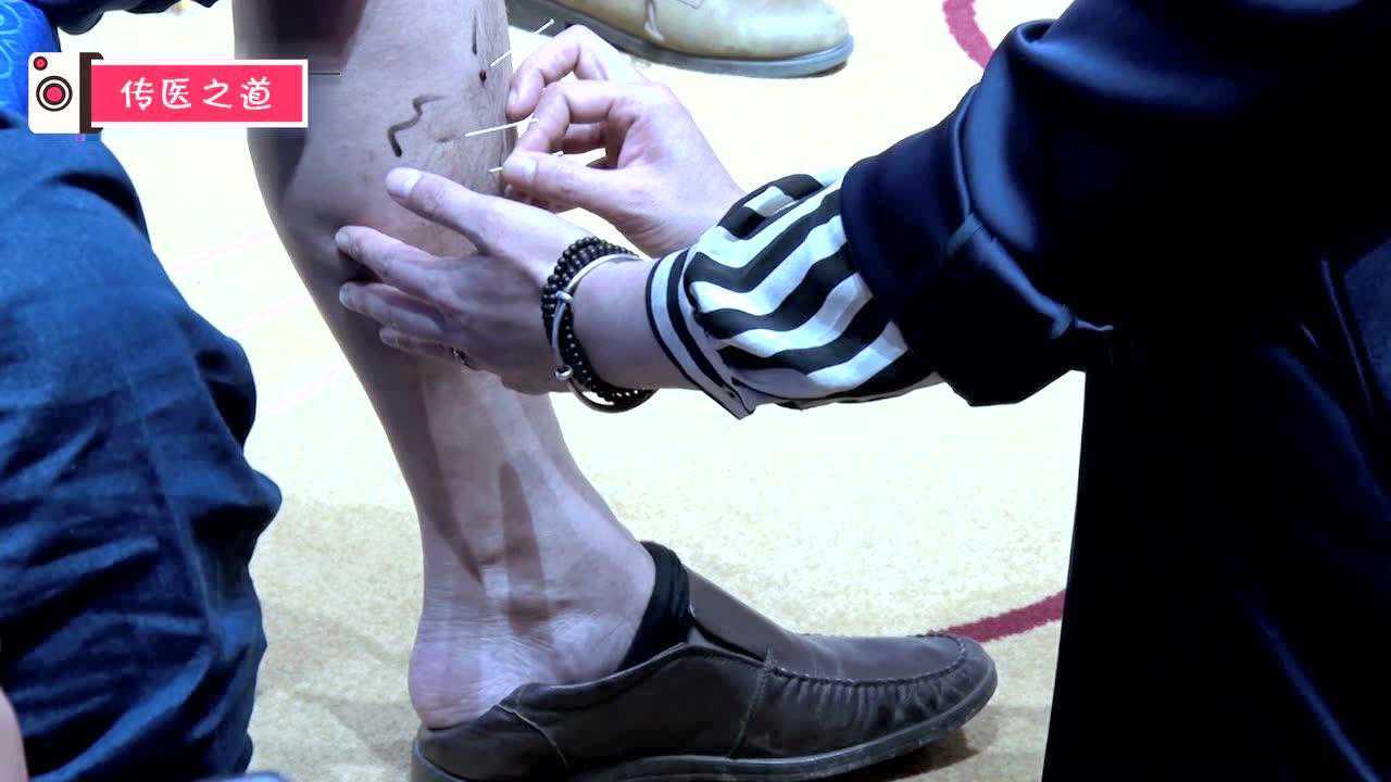 肾源三针开胸理气临床应用调理思路中医知识分享