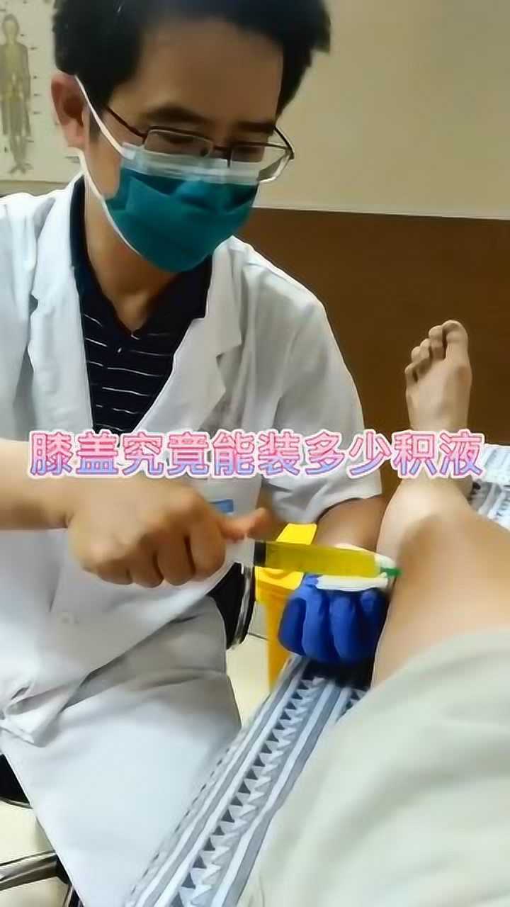 膝盖抽出来满满两管积液