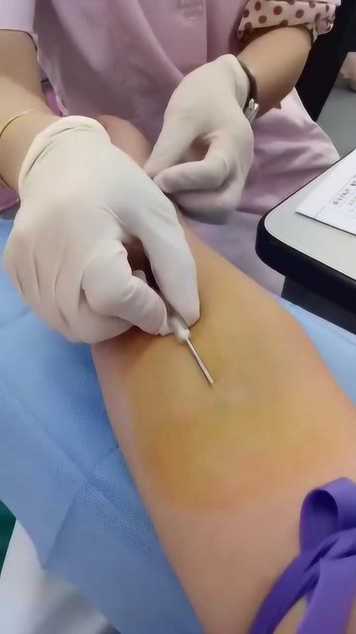 就是这么粗的针打消了我献血的热情看着好慌