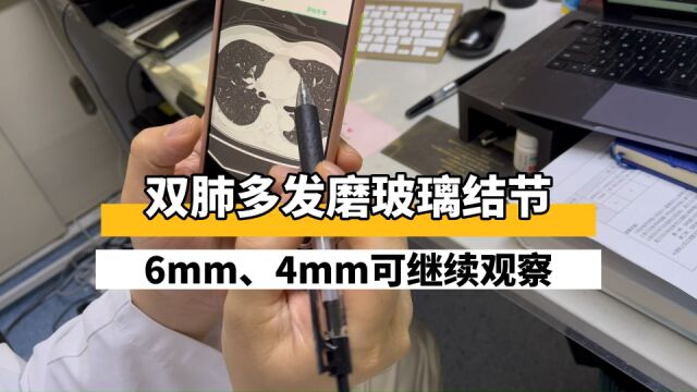 双肺多发磨玻璃结节,有6mm的、4mm的,要处理还是继续观察?