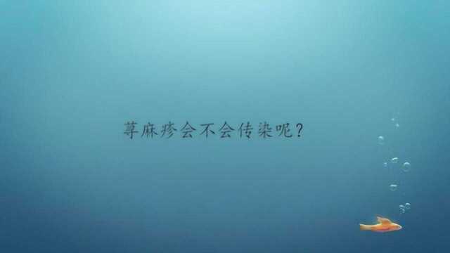 荨麻疹会不会传染呢?