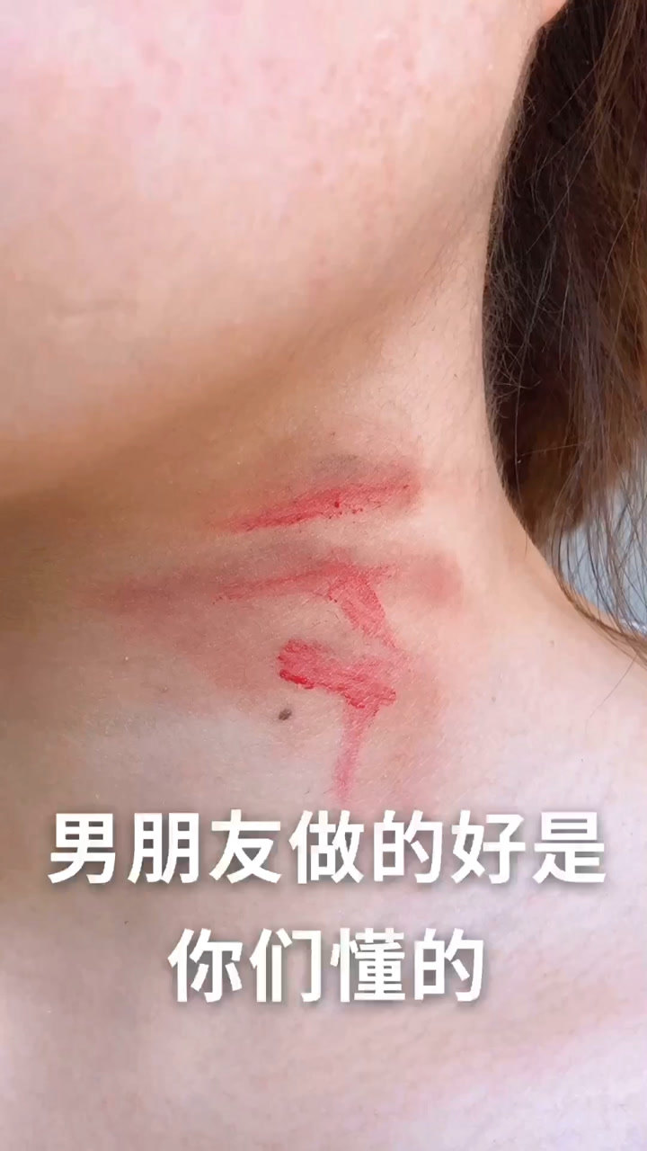 去除草莓印的小技巧