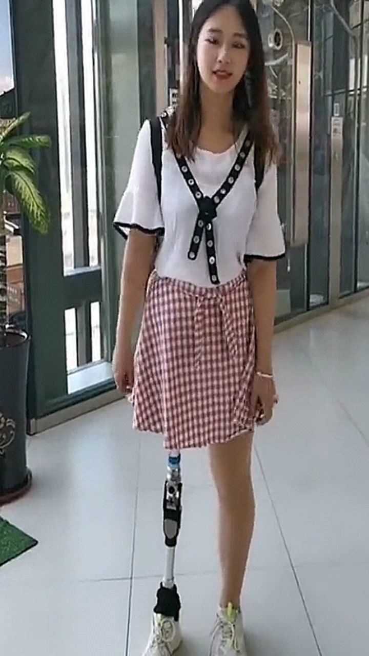 一晃髋离断截肢九年了