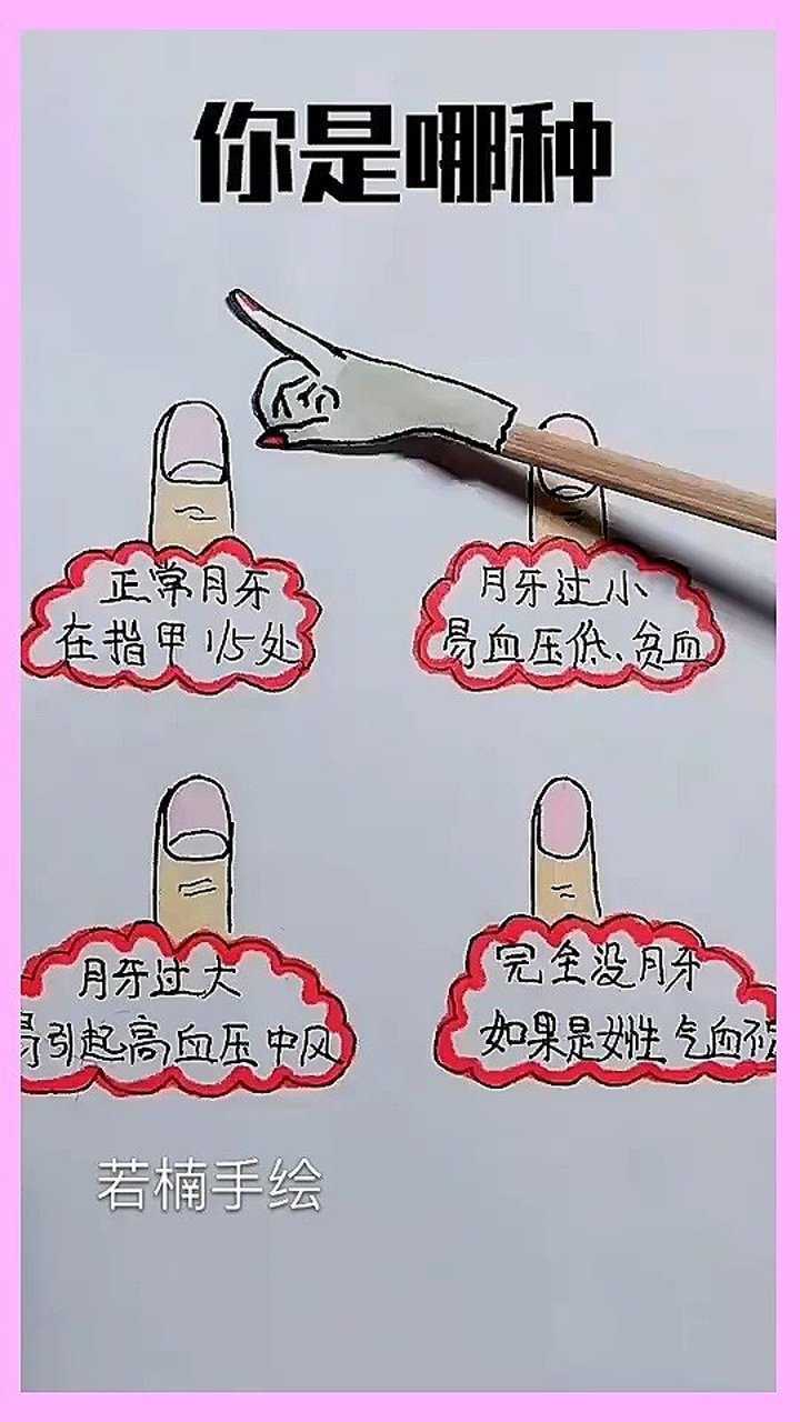 你的手指月牙是哪一种呢