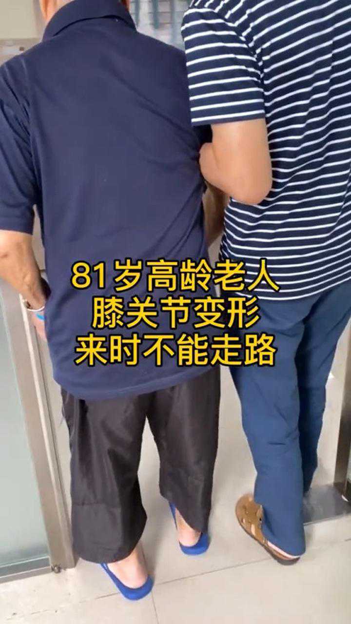 81歲老人膝關節變形不能走路