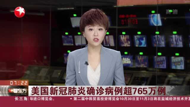 美国新冠肺炎确诊病例超765万例