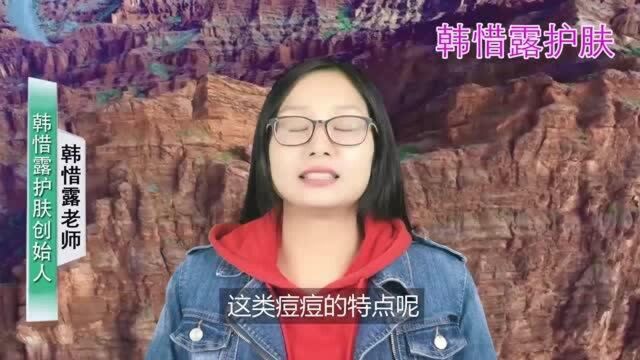 脸上长痘痘如何消除,脸上长痘痘用什么消,内分泌失调怎么调理脸上长痘痘