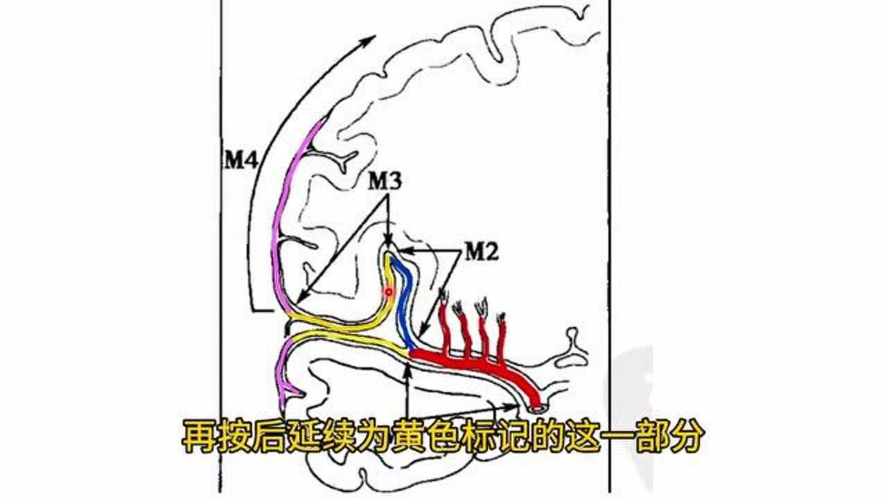 颅脑血管解剖一大脑中动脉分段建议收藏