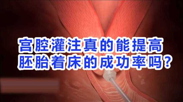 【泰国beyond医院】宫腔灌注真的能提高胚胎着床的成功率吗?