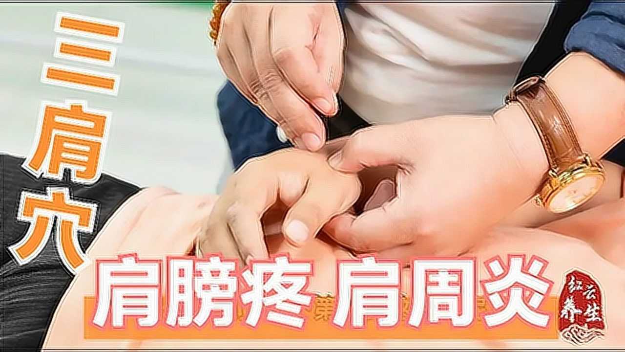 治疗肩膀疼肩周炎首选这组穴位中医针灸三肩穴针法教学