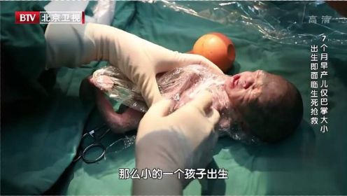 29周早产儿仅巴掌大小，为帮他保温，医生迅速给他包上一层保鲜膜！