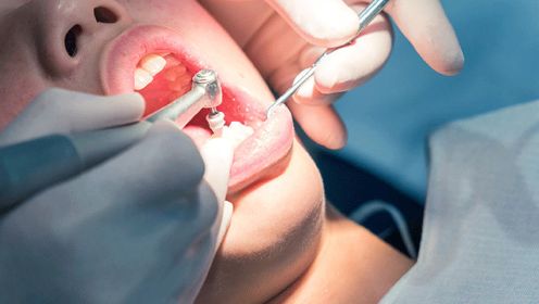 根管治疗牙髓化脓效果怎么样