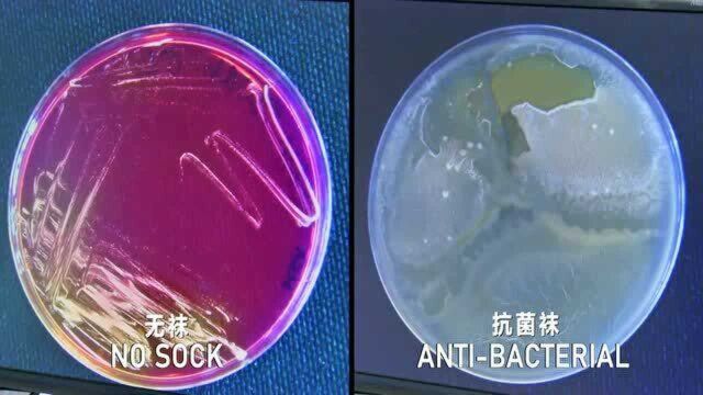 宣称抗菌的袜子真的会有抑菌防臭的作用吗?脚臭这个亘古难题究竟是何原因造成的?