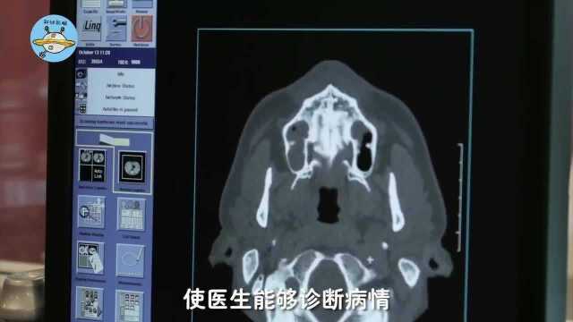 为什么CT检查特别贵?把CT机拆开后观察,看内部构造全明白了