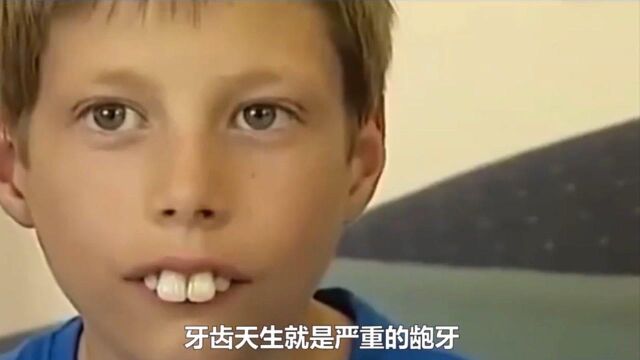 有些人长兔牙很可爱,有些人就真的是“兔子”,来看看“兔牙”男孩是怎么逆袭的.