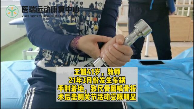 医瑞康复案例:41岁教师,尺骨鹰嘴骨折