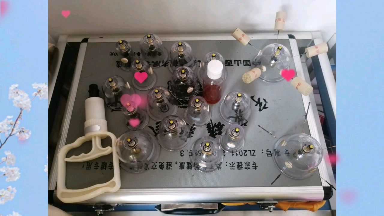 中华宇泉罐诊罐疗走进每个家庭