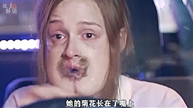 女孩天生屁股長在臉上,嘴長在屁股上,畸形人的奇葩遭遇!