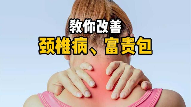 久坐致颈椎痛,还长出了富贵包?每天3个康复锻炼,改善肩膀疼痛