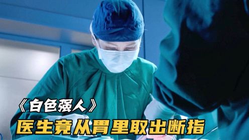 [图]小女孩被人侵犯，医生竟从她胃里找出断指，却没想到凶手也在医院