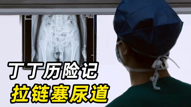 男孩把拉链塞进尿道,竟是因为太痒?医生得知原因,哭笑不得