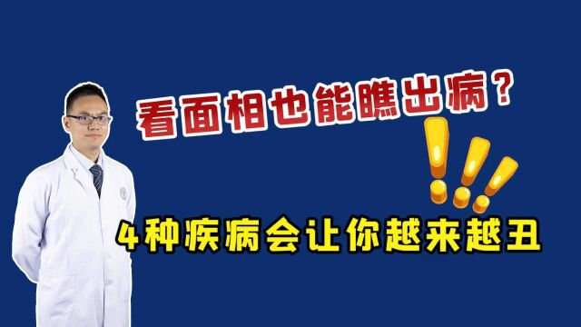 看面相也能瞧出病?这4种疾病,只会让你越来越“丑”!