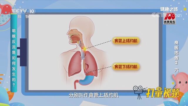 咽喉反流如何发生的?专家结合动画视频讲解,简单易懂