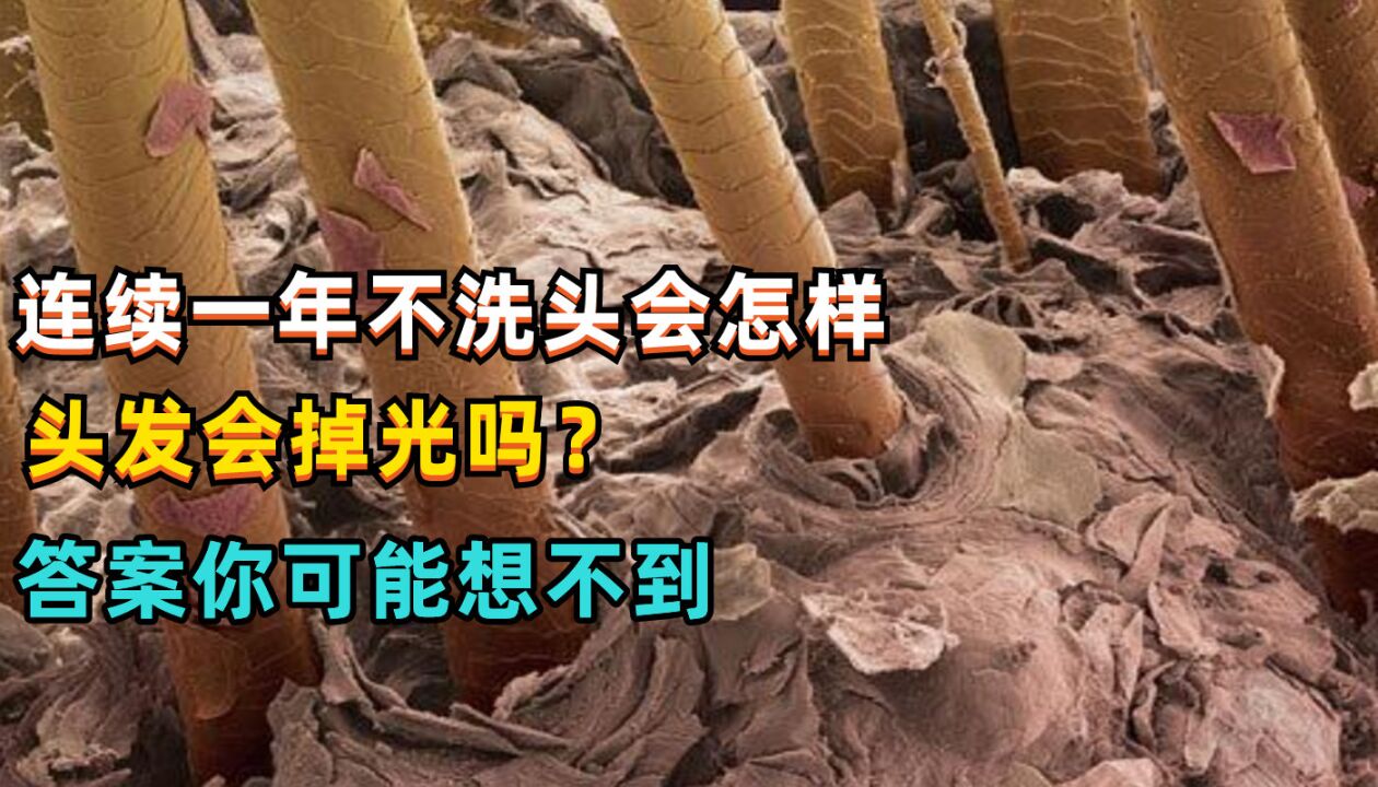 連續一年不洗頭會怎樣?頭髮會掉光嗎?答案你可能想不到