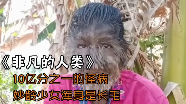 女孩患怪病浑身长毛,进入青春期之后,让她崩溃的事一件件全来了#影视纪社群征稿招募令#