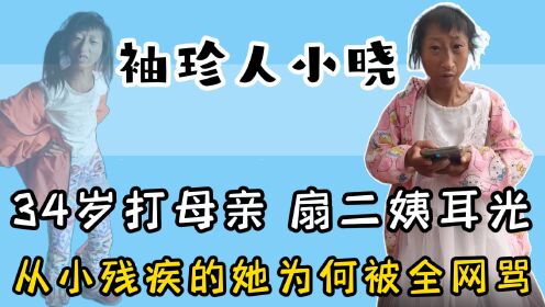 [图]袖珍人小晓成摇钱树？34岁身高1米1，网友为何对她从同情到谩骂