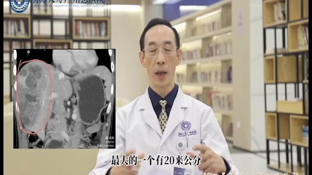 【前海人寿广州总医院】让肝癌晚期患者生命再起航